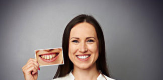 Laserowe wybielanie zębów