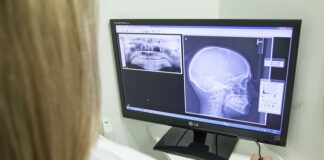 Czy można robić rtg przez gips? Czy można robić rtg przez gips?